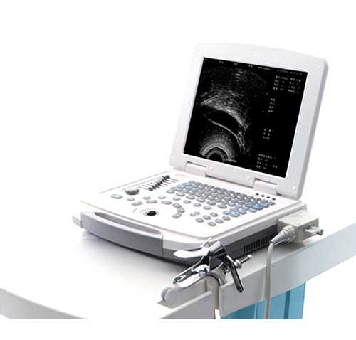 超声妇产科手术监视仪-可视人流机
